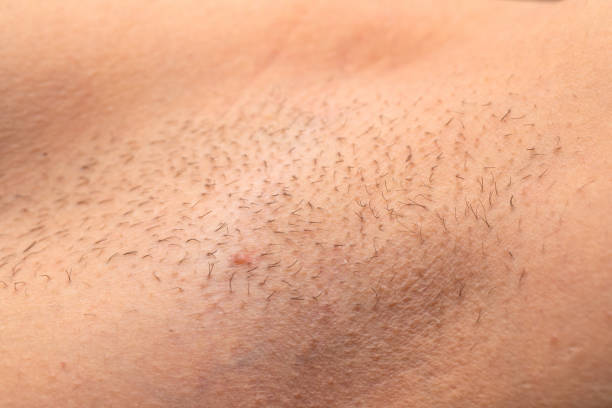 Unshaved armpit close up stock photo