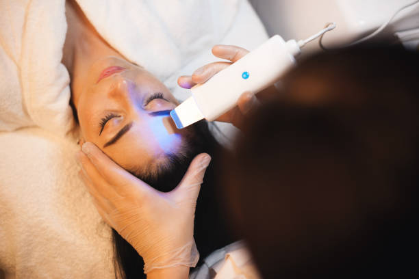 Upper view photo of a caucasian woman having a facial skin treatment procedures in a spa salon with modern apparatus stock photo