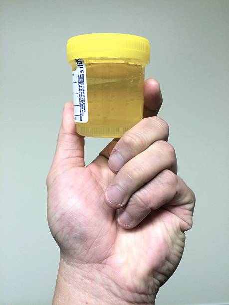 Urine Sample urine specimen container for urinalysis and drug testing urine stock pictures, royalty-free photos & images