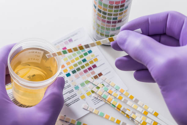 urine test strips in purple gloves Test tires in violet gloves with test chart and urine can urine test stock pictures, royalty-free photos & images