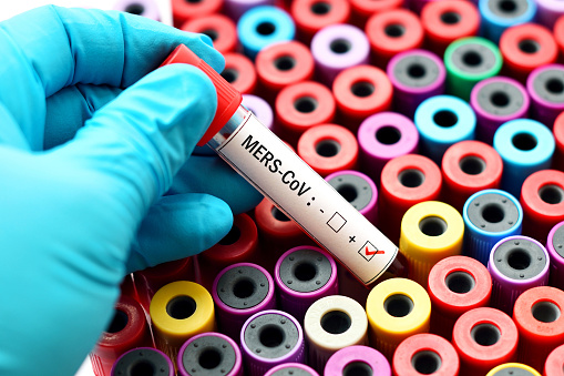 Blood sample positive with MERS virus