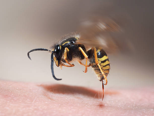 wasp sting pulls out of human skin. macro - wespen stockfoto's en -beelden