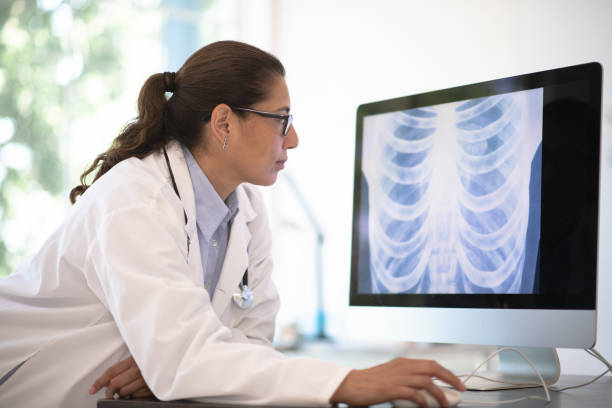 Woman doctor speculates on x-ray image A doctor of latino ethnicity leans on her desk and looks at a radiogram of a chest on her desktop computer. xray photos pictures stock pictures, royalty-free photos & images