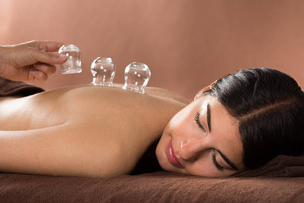 Woman Getting Cupping Treatment At Spa Woman Lying On Front Receiving Cupping Treatment On Back acupuncture stock pictures, royalty-free photos & images