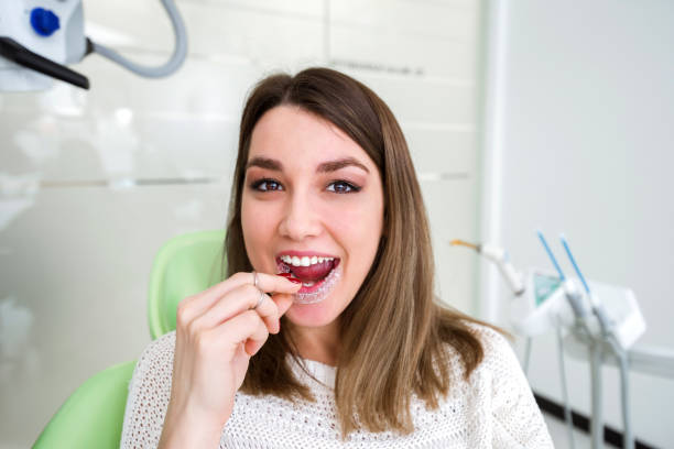 Invisalign Melbourne