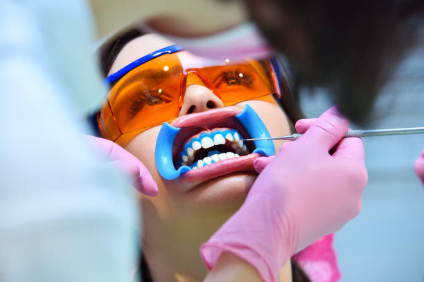 Woman patient with protective glasses for teeth whitening procedure. stock photo