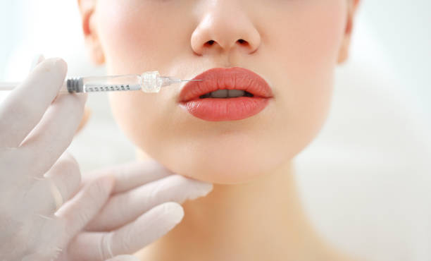 Woman receiving beauty injection in lips Closeup of crop anonymous female patient getting filler injection in lips in cosmetology clinic lip fillers stock pictures, royalty-free photos & images