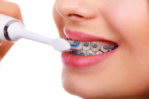 Woman Smiling Cleaning Teeth With Braces Stock Photo ...