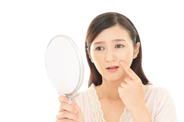 mujer que sufre de piel áspera - maquillaje kawaii fotografías e imágenes de stock