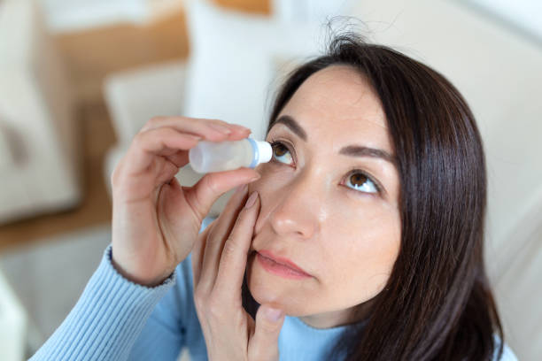 Woman using eye drop, woman dropping eye lubricant to treat dry eye or allergy, sick woman treating eyeball irritation or inflammation woman suffering from irritated eye, optical symptoms stock photo
