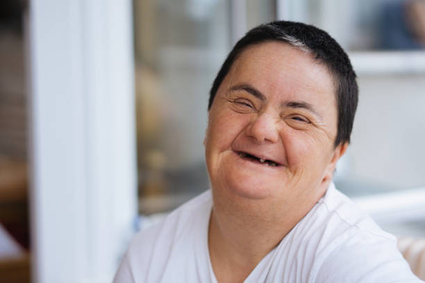 Woman with down syndrome smiling stock photo