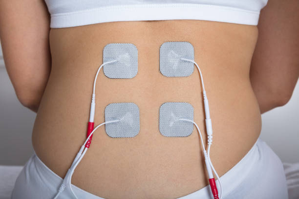 Woman With Electrostimulator Electrodes On Her Back Close-up Of A Woman With Electrostimulator Electrodes On Her Back electrode stock pictures, royalty-free photos & images