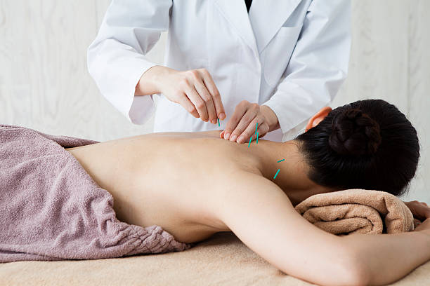 Women who are acupuncture back in the clinic  acupuncture stock pictures, royalty-free photos & images