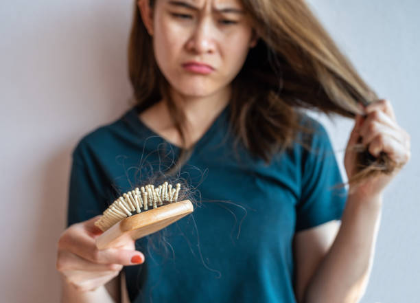 Worried woman holding comb with hair loss after brushing her hair. stock photo
