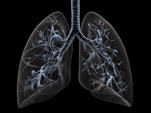 X-ray lungs stock photo