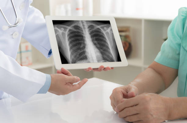 x-ray medical medical x-ray concept. doctor explaining the results of scan lung on digital tablet screen to patient. human skeleton photos stock pictures, royalty-free photos & images