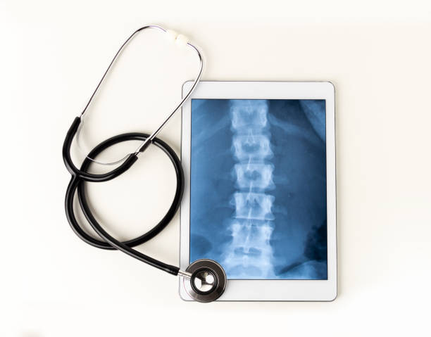 x-ray of a backbone A tablet and a stethoscope against a white background spine body part photos stock pictures, royalty-free photos & images