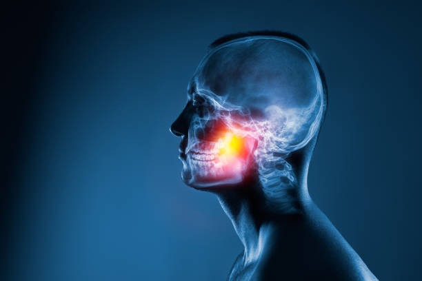 X-ray of a man's head on blue background. Jaw joint is highlighted by yellow red colour. stock photo