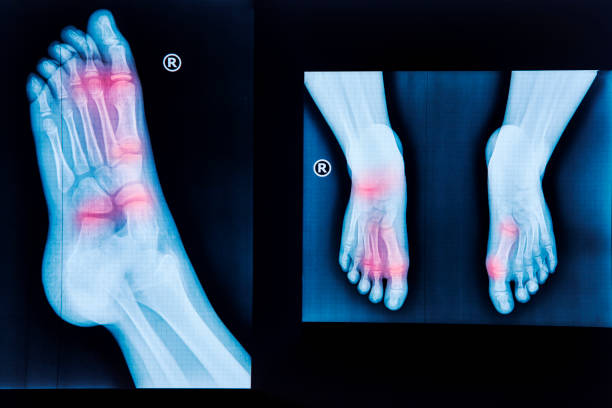 X-ray of human feet stock photo