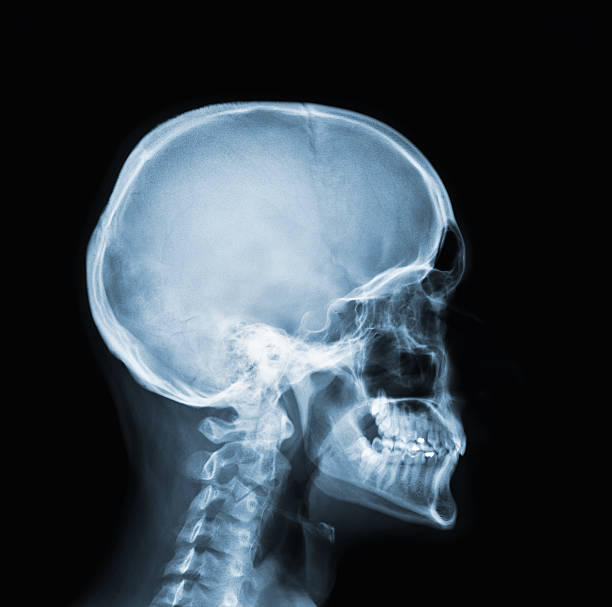 X-Ray photo of a human head and neck stock photo