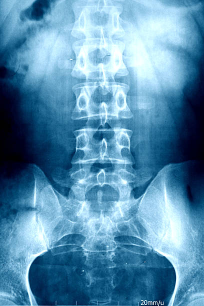 Xray Vertebra xray spine body part photos stock pictures, royalty-free photos & images