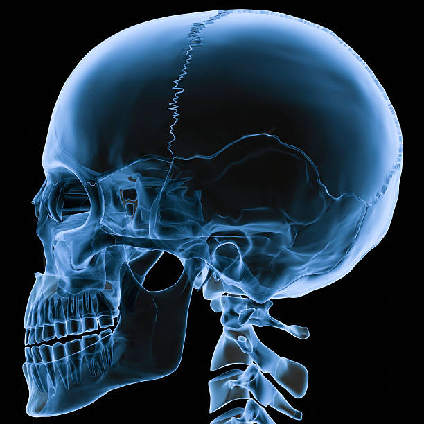 X-ray skull side view stock photo