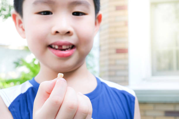 young  asia boy (6 years old) surprised to lost his top front milk teeth. he hold a teeth on his finger in the garden - lost first imagens e fotografias de stock