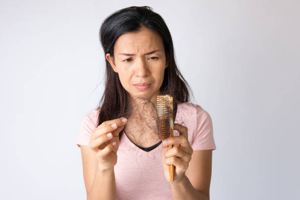 Young asian woman is very upset because of hair loss stock photo