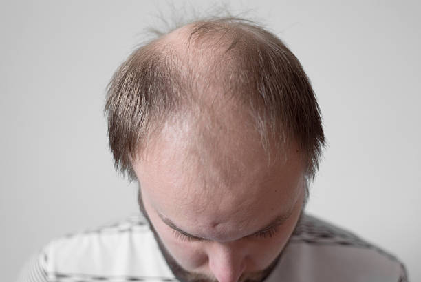 Skinny bald man