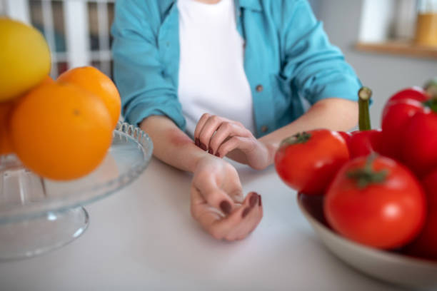 Young woman eating products causing an alergy Being alergic to tomatoes and oranges. Woman eating products causing an alergy allergy stock pictures, royalty-free photos & images