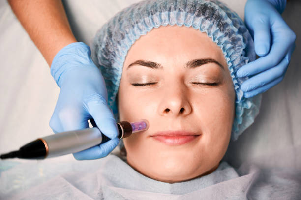 Young woman having fractional mesotherapy at wellness center. stock photo