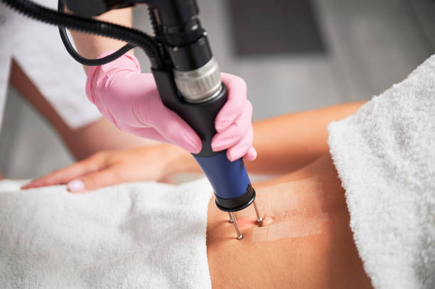 Young woman receiving abdominal laser treatment in clinic. stock photo