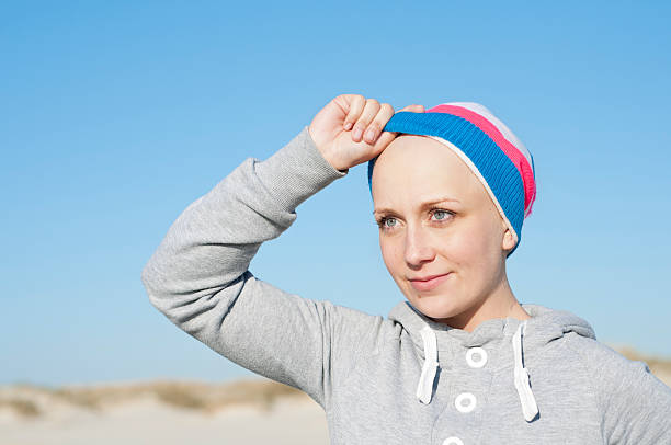 jovem mulher mostrando bald head como efeito secundário de quimioterapia - bald beach imagens e fotografias de stock