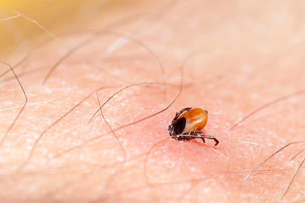 Zecke - Tick - Ixodes ricinus tick on human skin macro body hair stock pictures, royalty-free photos & images