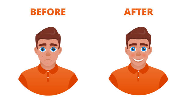Acne treatment concept The result of acne treatment. A sad guy with acne becomes happy without. pics for amoxicillin stock illustrations