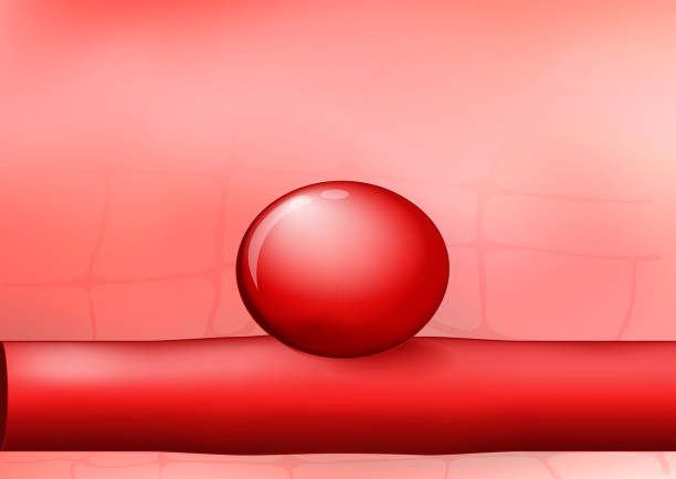 артерии с аневризмой на красном фоне - laporta stock illustrations