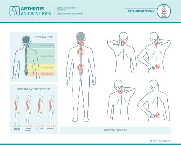 Back pain infographic Back pain and body posture infographic with anatomical illustrations spine body part stock illustrations