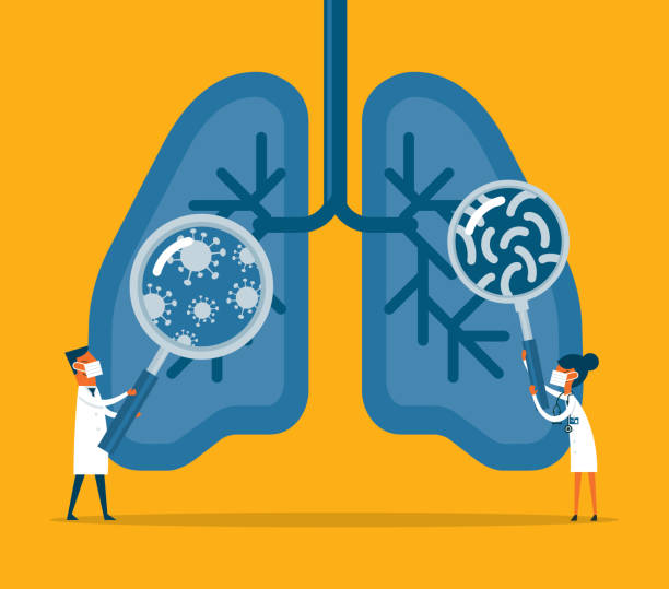 Bacteria and viruses on human lungs vector art illustration