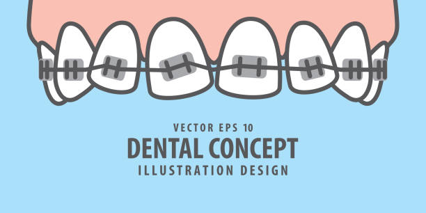 Download Crooked Teeth Illustrations, Royalty-Free Vector Graphics ...