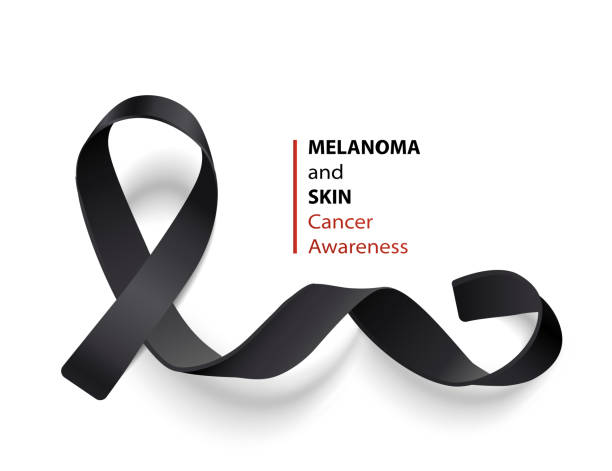 melanom ve cilt kanseri bilinçlendirme kampanyası için siyah kurdele afiş - istırap stock illustrations