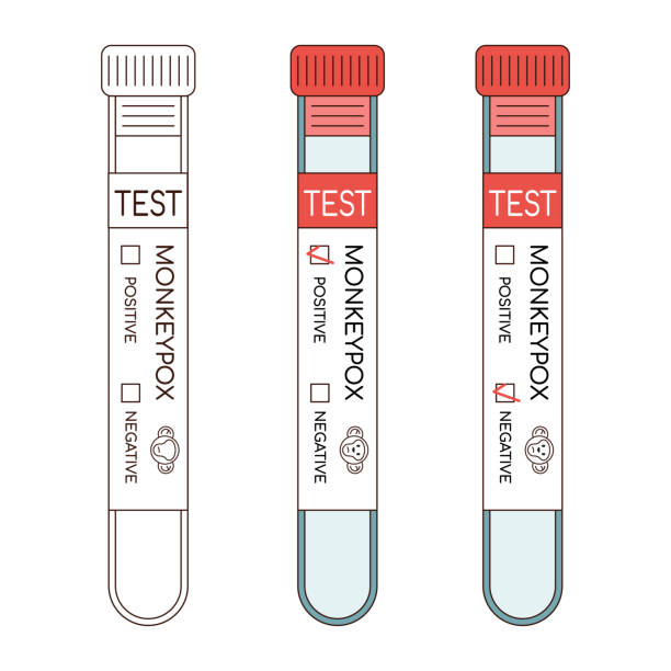 Blood sample tube for Monkeypox virus test. Blood sample tube for Monkeypox virus test. Line and color variation monkeypox vaccine stock illustrations