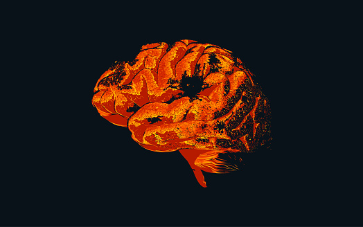 Brain damage illustration isolated on black BG