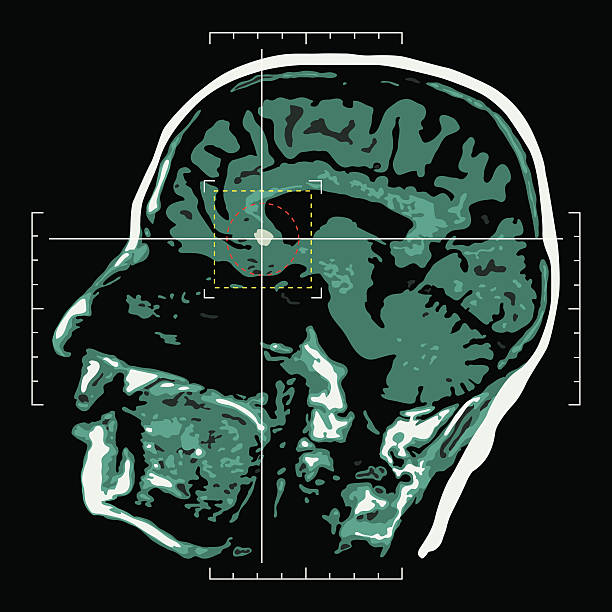 Brain - target vector art illustration