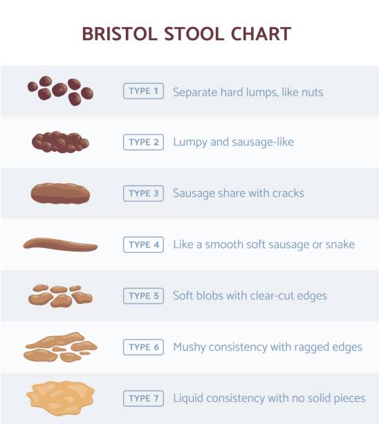 Bristol stool chart for faeces type classification, flat vector illustration. Bristol stool chart infographic for faeces type classification, flat vector illustration. Medicine method of diagnostic for abdomen and digestive system diseases. stool stock illustrations