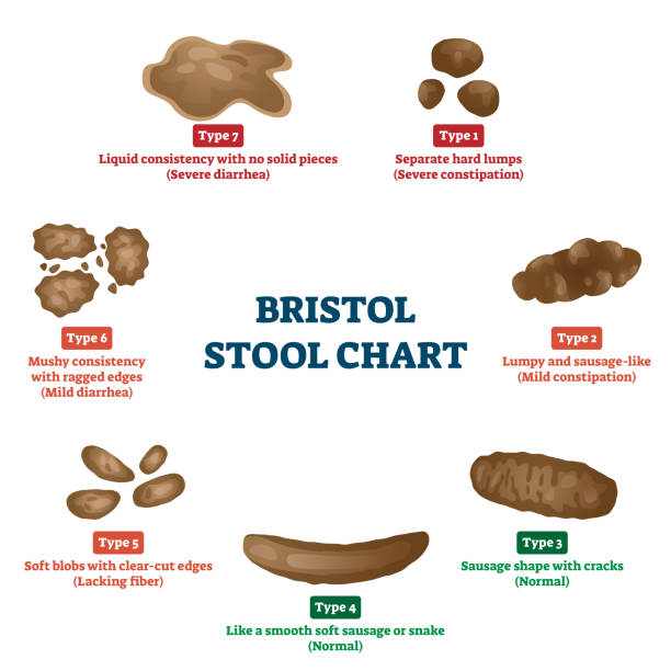 Bristol stool chart tool for faeces type classification vector illustration Bristol stool chart tool for faeces type classification vector illustration. Anatomical medicine diagnostic method for patient abdomen problems. Constipation and diarrhea digestive division scheme. stool stock illustrations