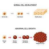 Cancer cells. illustration showing cancer disease development. Healthy tissue and Malignant tumour.  Vector diagram for your design, educational, biological, science and medical use