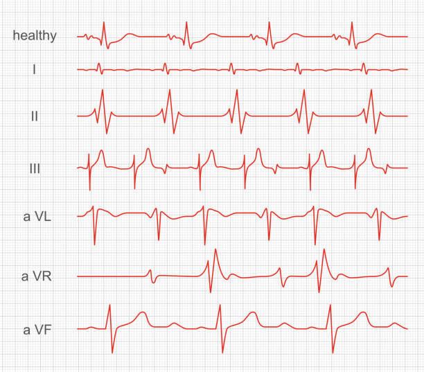 Cardiogram, heart red rhythm on monitor screen Cardiogram, heart red rhythm on monitor screen. Record of muscle activity within made by a cardiograph. Vector illustration pulse trace stock illustrations