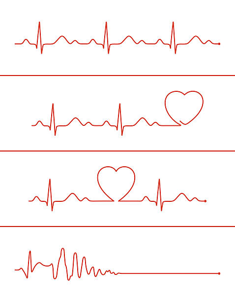 Cardiogram lines set Set of various cardiogram design elements. Cardiogram lines of healthy heart and heart stop listening to heartbeat stock illustrations