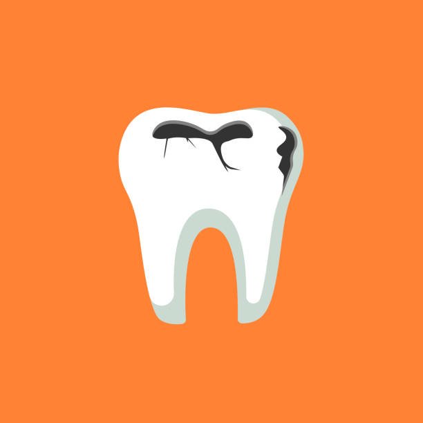 Caries dental problems. Tooth with caries icon. Big hole in the human teeth on isolated background. EPS 10 vector Caries dental problems. Tooth with caries icon. Big hole in the human teeth on isolated background. EPS 10 vector. rotten teeth in children stock illustrations