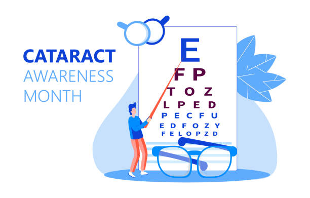 Cataract awareness month is celebrated in June. Glaucoma disease and nephropathy problems. Ophthalmologist concept illustration. Eyesight check up with tiny people character for web. Cataract awareness month is celebrated in June. Glaucoma disease and nephropathy problems. Ophthalmologist concept illustration. Eyesight check up with tiny people character for apps, web. diabetes awareness month stock illustrations